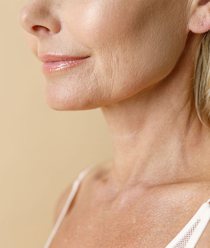 How Long Does a Neck Lift Last?