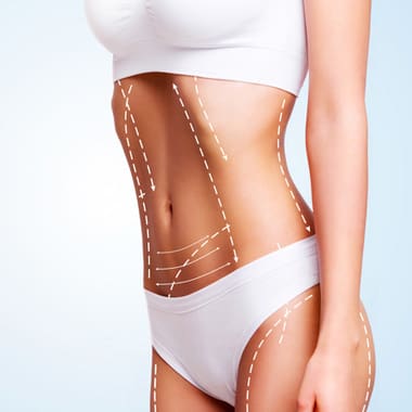 Liposuction-Body-Img